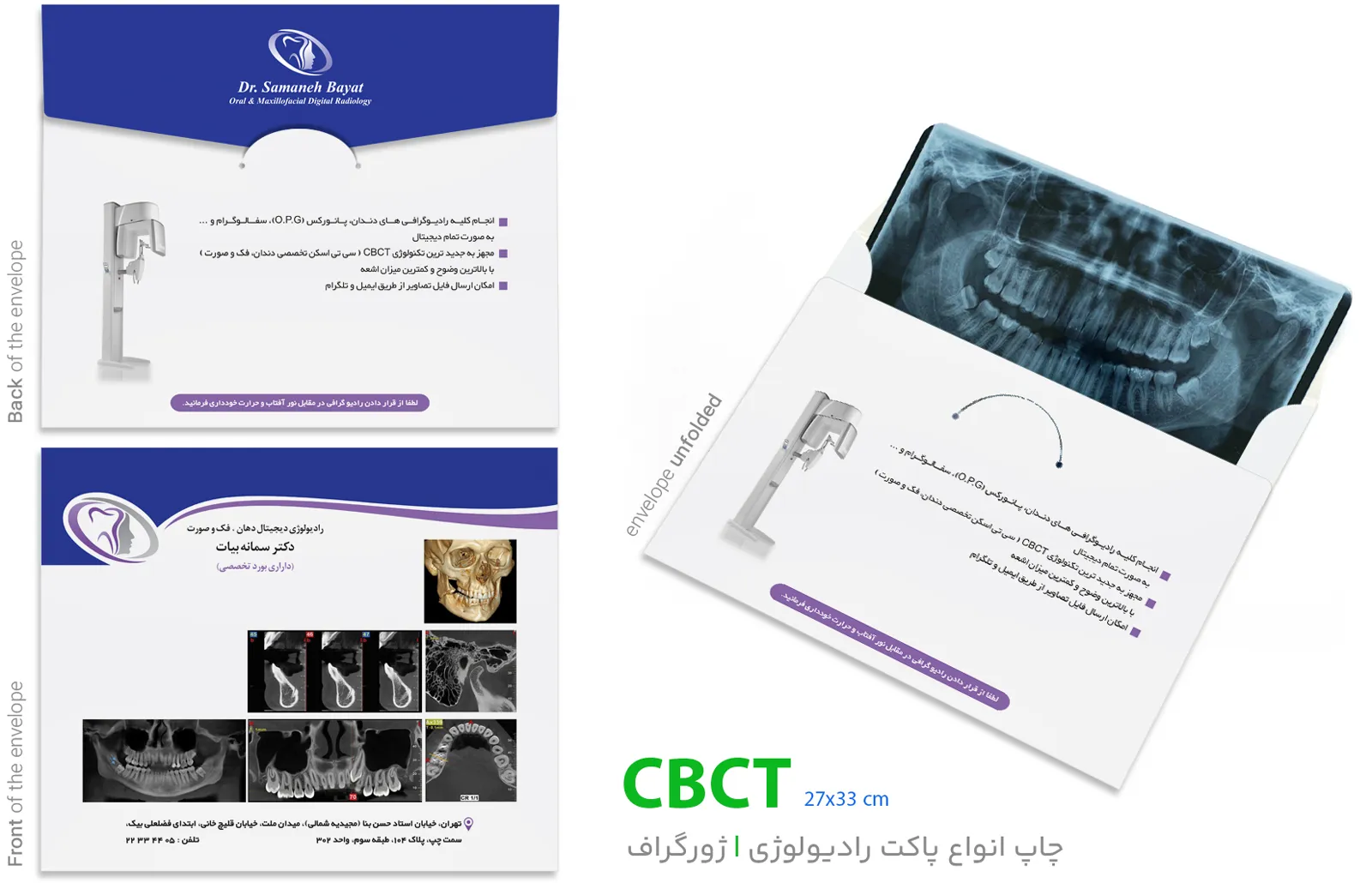 پاکت CBCT در نمای باز و بسته شده پاکت