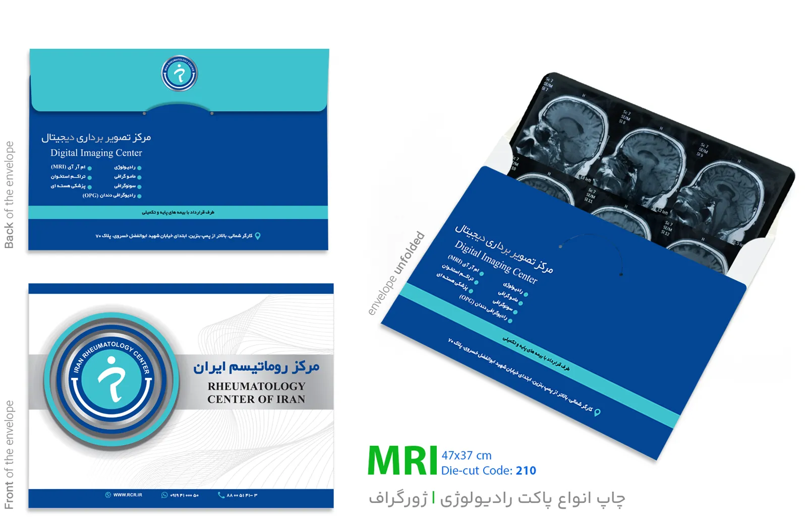 چاپ پاکت MRI در نمای بسته و باز شده پاکت